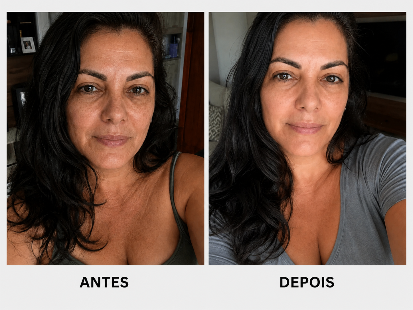 antesedepois1