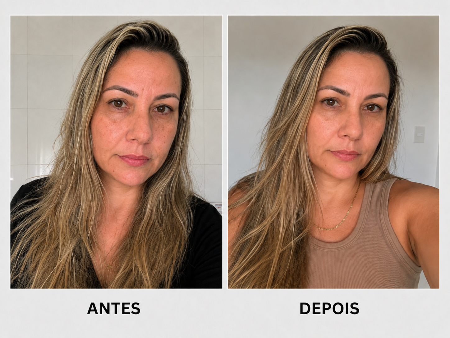 antesedepois2