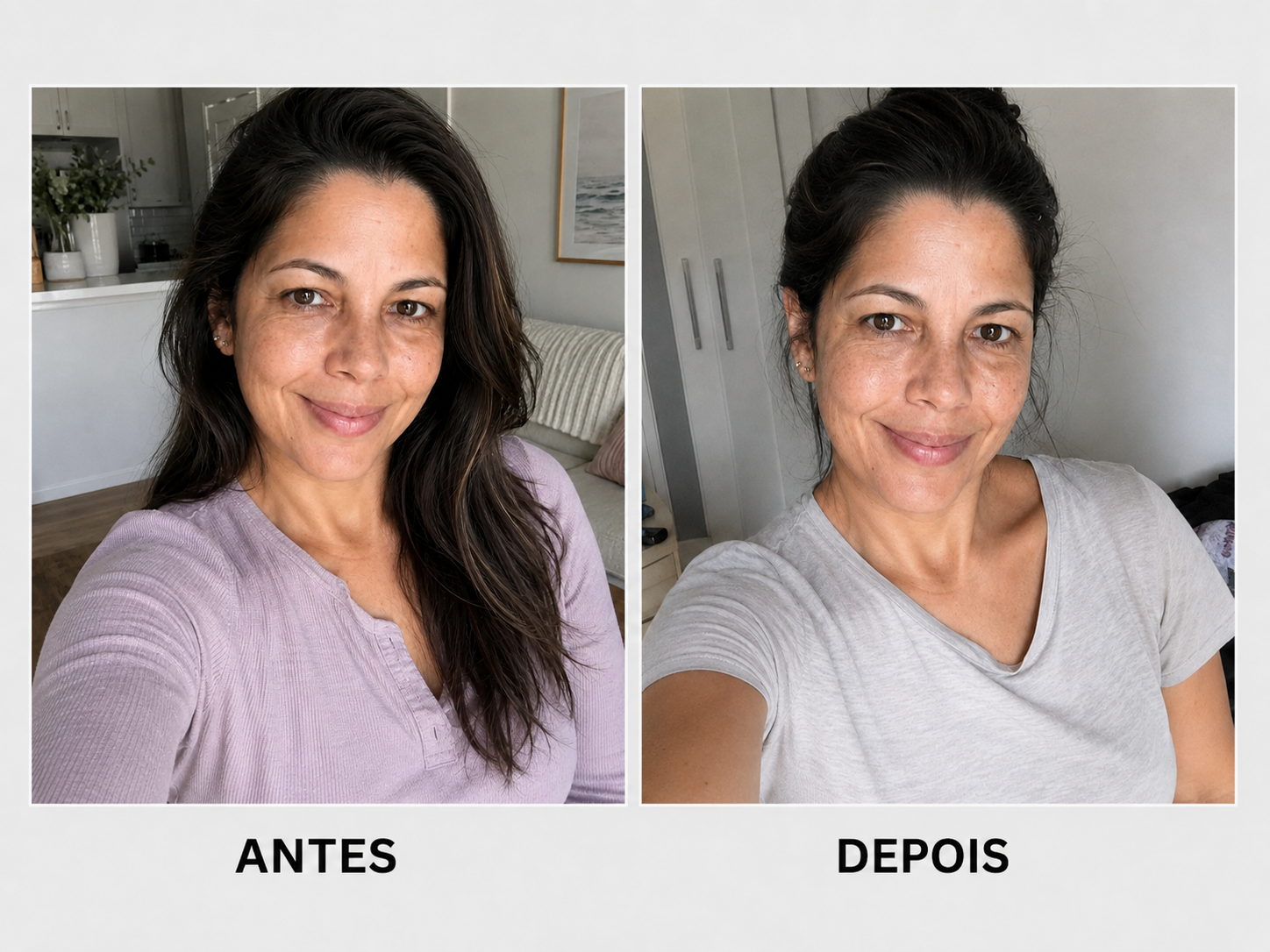 antesedepois3